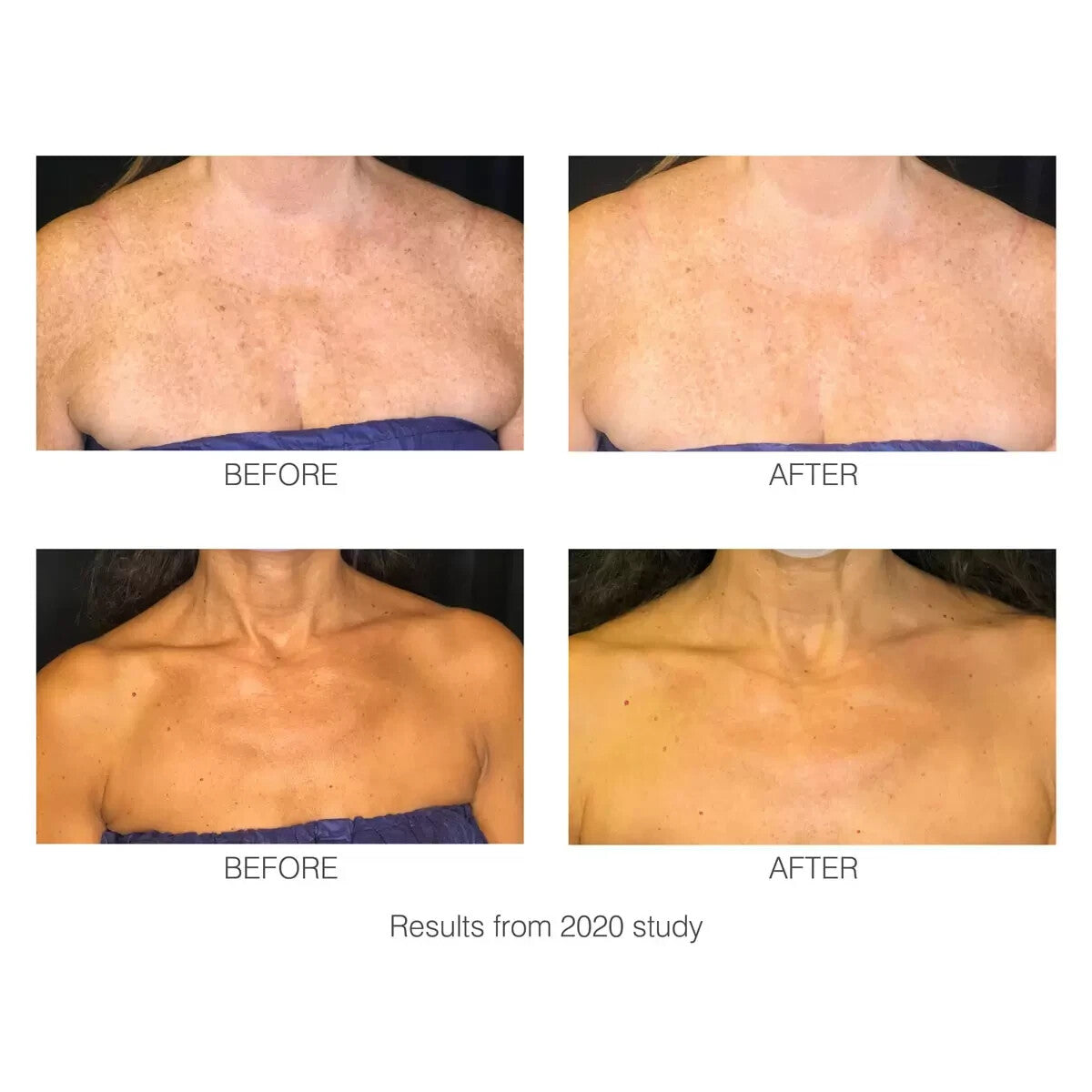 Rio decoLITE Beauty Boosting LED Treatment - New Box open